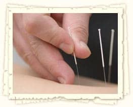 Las Vegas Acupuncture Acupuncture in Las Vegas area