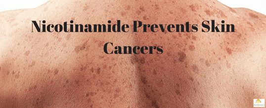 Nicotinamide-can-prevent-skin-cancers.