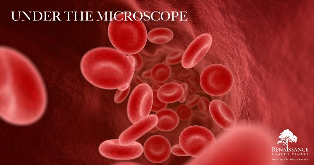 UNDER THE MICROSCOPE- Live Blood Assessment