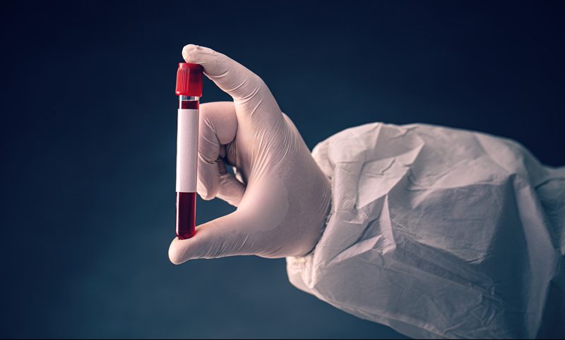 test tube with blood sample 2021 08 27 14 00 09 utc