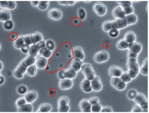 Figure 1. Individual Platelets