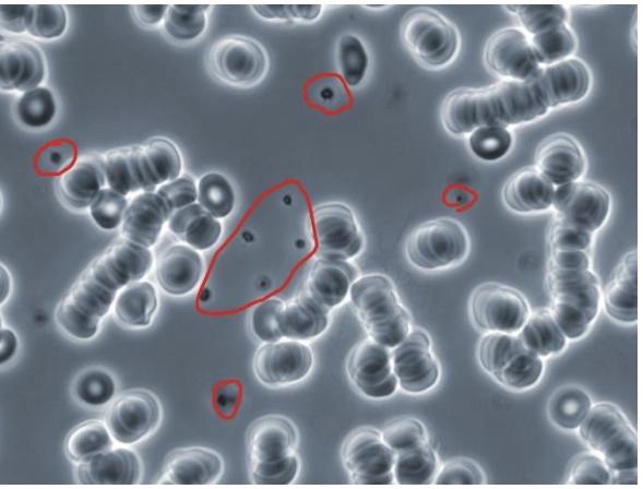Individual Platelets