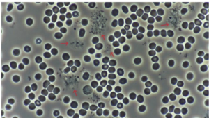 Figure 2. Platelet Aggregation